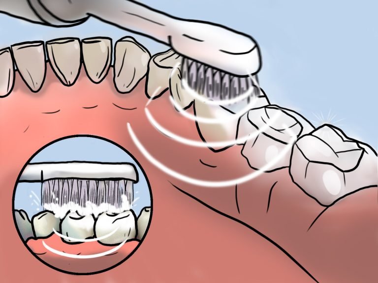 Illustration of a toothbrush head near the teeth with wave lines representing ultrasound.