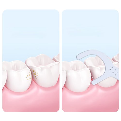 How-to-use-dental-floss